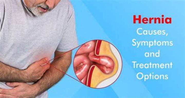 Are perineal hernias painful?