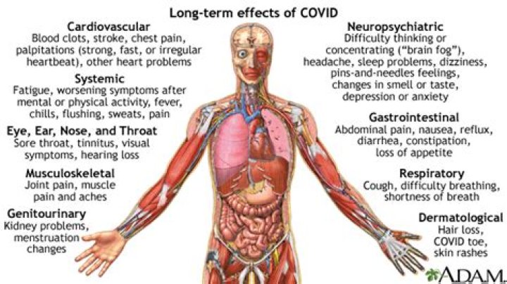 Are there lingering effects of covid?