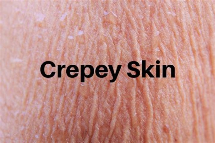 At what age does crepey skin start?