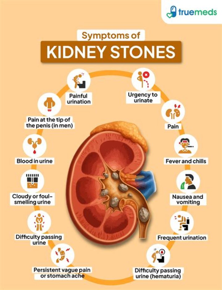Can a kidney stone cause brown urine?