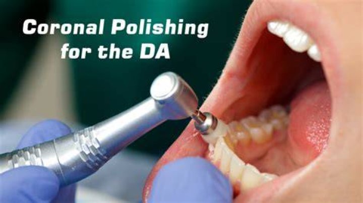 Can dental assistant do coronal polishing?