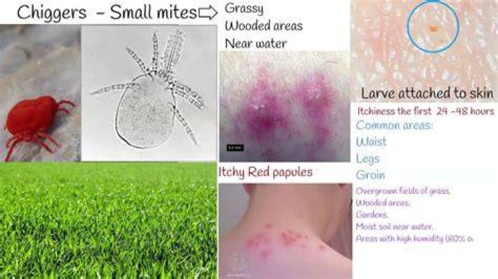 Can harvest mites live on humans?