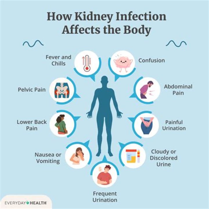 Can kidney infections cause infertility?