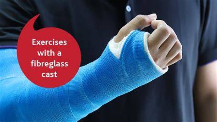 Can you drive with an arm cast?