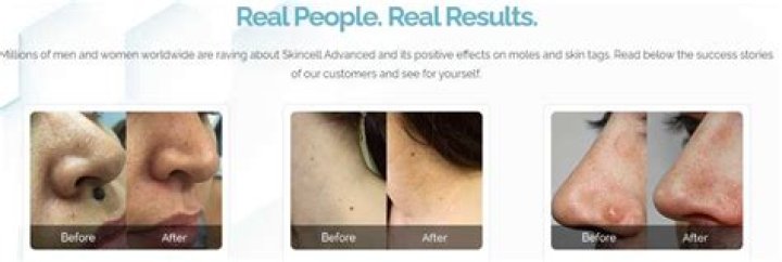 Did skincell pro appear on shark tank?