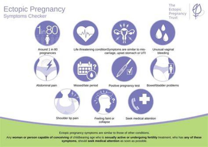 Did you have pregnancy symptoms with ectopic?