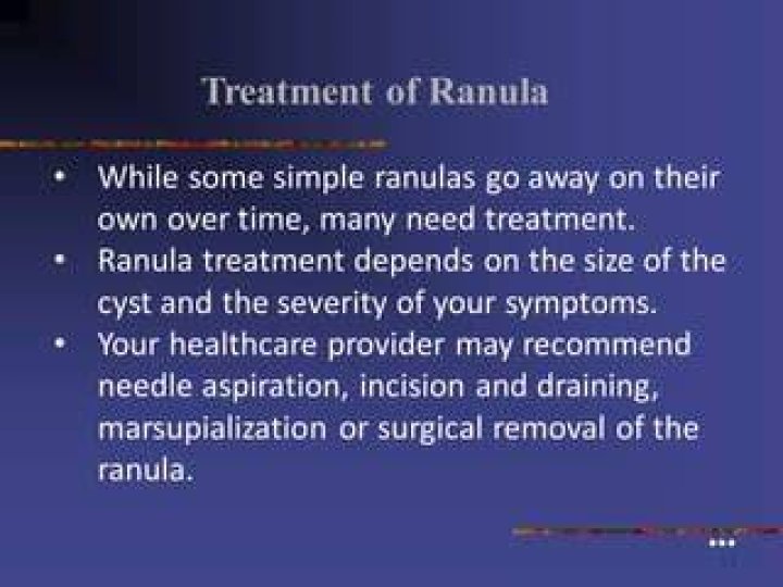 Do ranulas go away on their own?