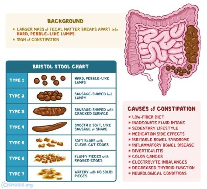Do you lose pounds when you poop?