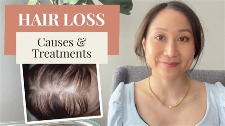 Does dermatologist treat hair loss?