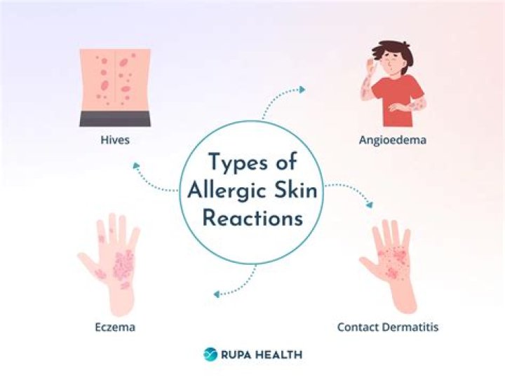 During allergic reaction which of the following is secreted?