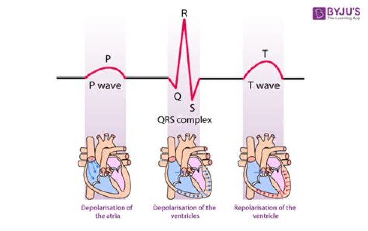 During which component of the ecg/ekg are the ventricles repolarizing?