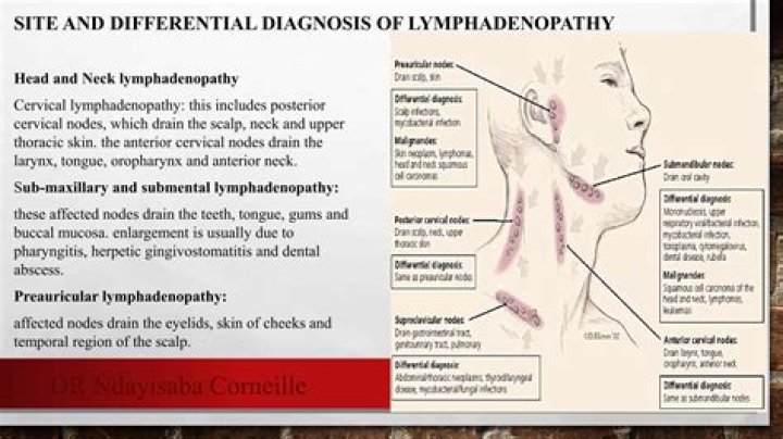 How to treat adenopathy?