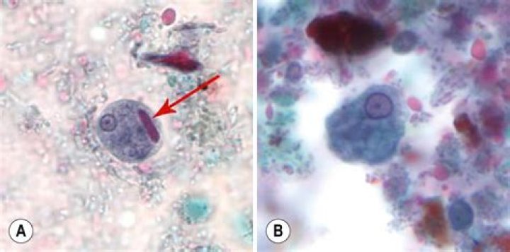Is entamoeba histolytica dangerous?