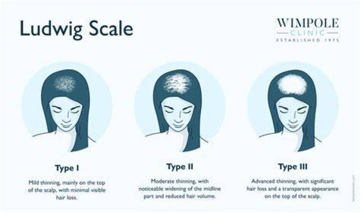 Is hair lip hereditary?