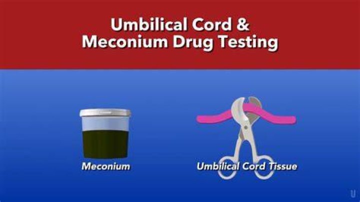 Is meconium drug testing mandatory in texas?
