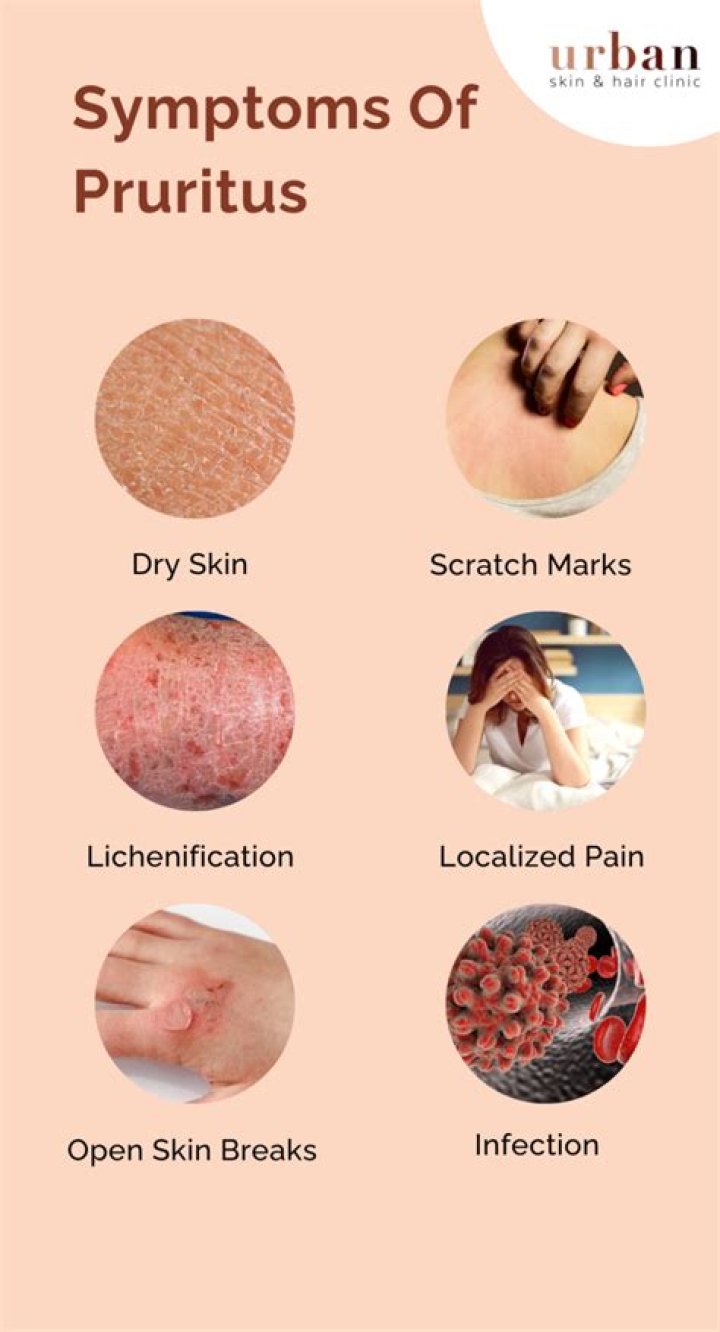 Is pruritus a sign of cancer?
