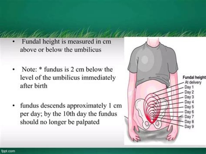 Should the fundus be firm after birth?