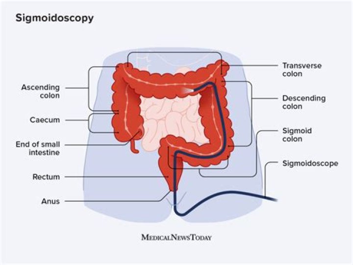 sigmoid image