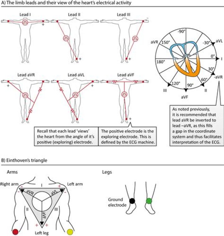 What are the types of electrocardiographs used in medical offices?
