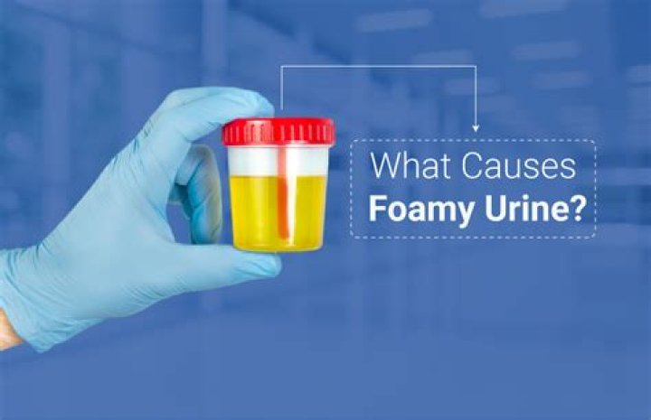 What is the treatment for foamy urine?