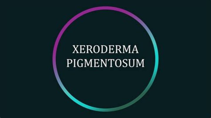 What is xeroderma pigmentosum (xp)?