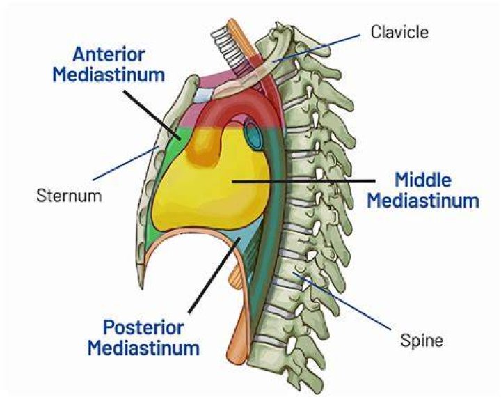 Where is anterior mediastinal mass?
