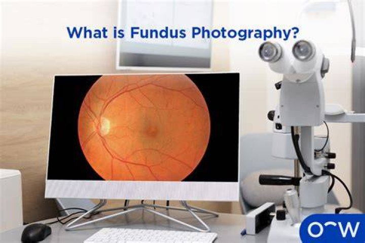 Who is fundus photography?