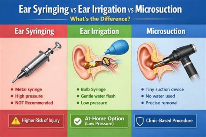 Why can't i get my ears syringed on nhs?