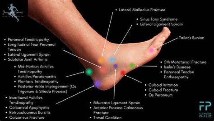 Why do the front of my feet hurt?